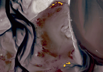 Detection of mussel reefs with satellite imagery