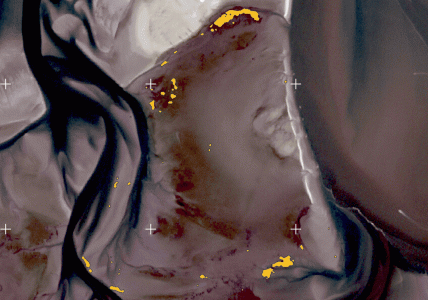 Detection of mussel reefs with satellite imagery